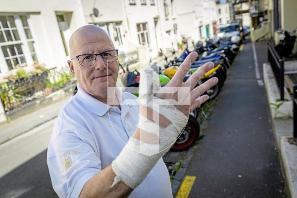 Picture by Peter Frankland. 07-07-25 Wayne Olliver recently fell off his motorbike on Kings Road when he sliped on a manhole cover and needed surgery to his hand. He is concerned that there are many in the island which are unsafe for motorcyclists and cyclists.